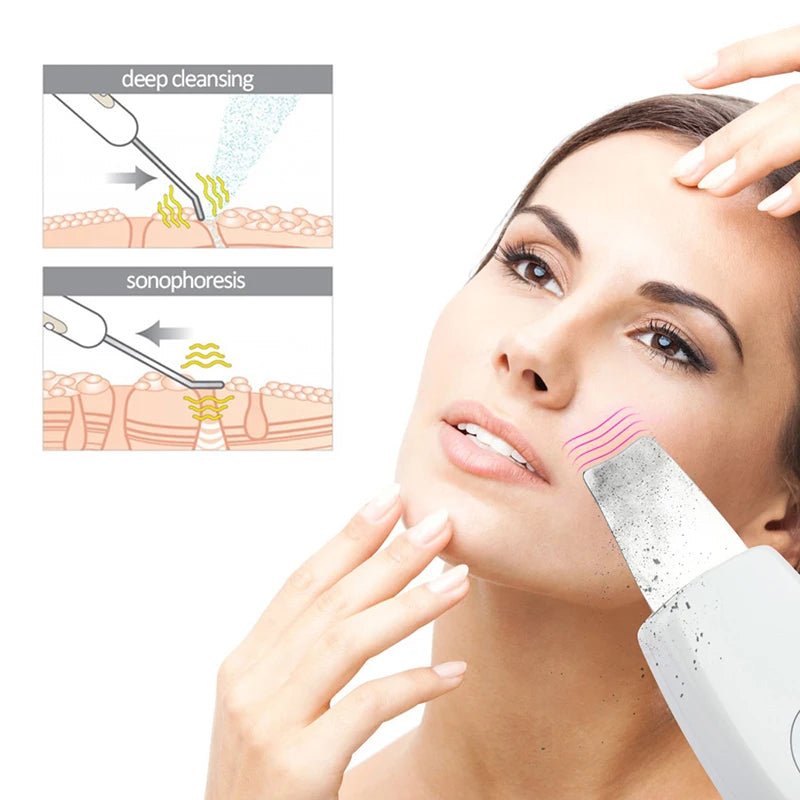 Ultrasonic Skin Scrubber Deep Facial Cleaner