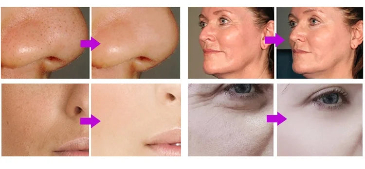 Ultrasonic Skin Scrubber Deep Facial Cleaner