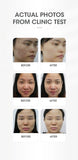 DEESS Multifunctional Beauty Device Fashion