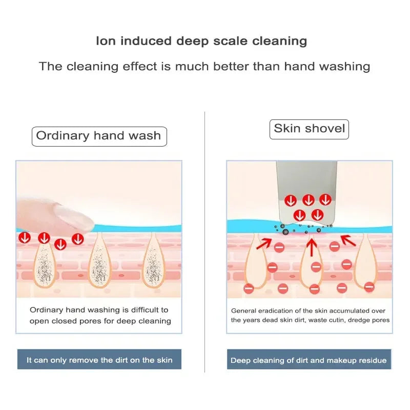 Ultrasonic skin scrubber facial ion cleaning vibrating