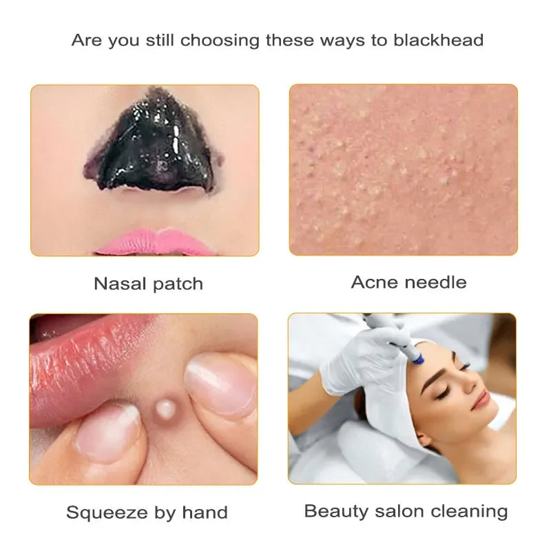Ultrasonic skin scrubber facial ion cleaning vibrating